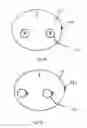 Fig. 04 - Method Of Manufacturing An Optical Lens