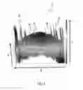 Fig. 02 - Apparatus for optical coherence tomography of an eye and method for optical coherence tomography of an eye