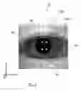 Fig. 06 - Apparatus for optical coherence tomography of an eye and method for optical coherence tomography of an eye