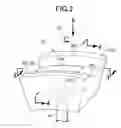 Fig. 03 - Metal element deformation state detection device