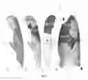 Fig. 07 - Visualization and characterization of pulmonary lobar fissures