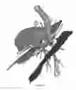 Fig. 09 - Visualization and characterization of pulmonary lobar fissures