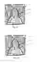 Fig. 08 - Object segmentation