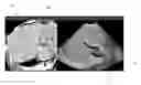 Fig. 01 - Ultrasound imaging system and method for image guidance procedure