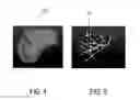 Fig. 05 - Ultrasound imaging system and method for image guidance procedure
