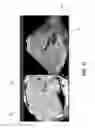 Fig. 12 - Ultrasound imaging system and method for image guidance procedure