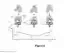 Fig. 08 - Method for determining contact position parameters of a joint connecting two bones