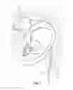 Fig. 02 - Selective Noise-Cancelling Earphone