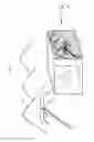 Fig. 02 - Device for ambience obstruction by an object