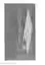 Fig. 07 - Transducer in a casing having an output window