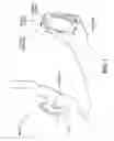 Fig. 02 - Hearing aid detection