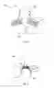 Fig. 07 - Method and apparatus for improving hearing aid antenna efficiency