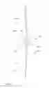 Fig. 07 - Articulated garden rake