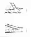 Fig. 02 - Device for guiding growth of scaffold branches