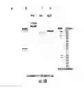 Fig. 09 - HUMANIZED TRANSGENIC SINGLE NUCLEOTIDE POLYMORPHISM ANIMAL SYSTEMS