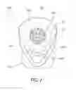 Fig. 06 - Oral care implement and method of forming an oral care implement