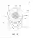 Fig. 08 - Oral care implement and method of forming an oral care implement