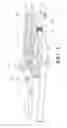 Fig. 06 - Support cushions and methods for dissipating heat away from the same