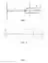Fig. 02 - Inspection positioning prostatic capsule expansion catheter