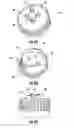 Fig. 06 - Water bottle cap assemblies for an endoscopic device