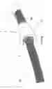 Fig. 06 - ENDOSCOPE GUIDE TUBE