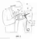 Fig. 02 - Flow rate sensor system and method for non-invasively measuring the flow rate of a bodily fluid