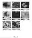 Fig. 09 - Optical transfer diagnosis (OTD) method for discriminating between malignant and benign tissue lesions