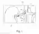 Fig. 02 - POSITIONING TOOL