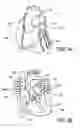 Fig. 04 - Method of determining the blood flow through coronary arteries