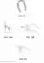 Fig. 09 - Suture passers adapted for use in constrained regions