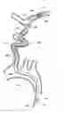 Fig. 01 - SYSTEMS AND METHODS FOR CATHETER ADVANCEMENT