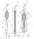Fig. 02 - SYSTEMS AND METHODS FOR CATHETER ADVANCEMENT