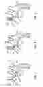 Fig. 03 - SYSTEMS AND METHODS FOR CATHETER ADVANCEMENT