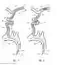 Fig. 04 - SYSTEMS AND METHODS FOR CATHETER ADVANCEMENT