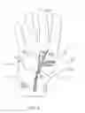 Fig. 04 - Therapeutic skin lifting device and related systems and methods