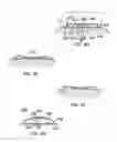 Fig. 12 - Therapeutic skin lifting device and related systems and methods
