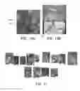 Fig. 09 - MARKERLESS TRACKING OF ROBOTIC SURGICAL TOOLS