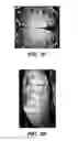 Fig. 04 - Tissue markers and uses thereof