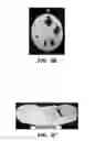 Fig. 06 - Tissue markers and uses thereof
