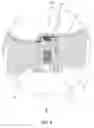 Fig. 06 - Sinus implant