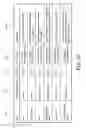 Fig. 09 - Pressure sensing electric toothbrush
