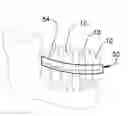 Fig. 01 - Article and method for controlling oral-originated systemic disease