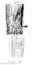Fig. 05 - Article and method for controlling oral-originated systemic disease