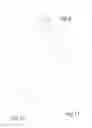 Fig. 09 - Insertion Tool for a Heart Valve