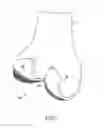 Fig. 03 - Anatomically adapted orthopedic implant and method of manufacturing same