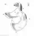 Fig. 04 - Anatomically adapted orthopedic implant and method of manufacturing same
