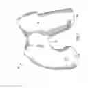 Fig. 08 - Anatomically adapted orthopedic implant and method of manufacturing same