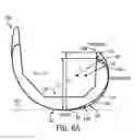 Fig. 09 - Prosthesis and method for using prosthesis to facilitate deep knee flexion