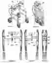 Fig. 07 - Mobility assistance device