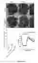 Fig. 07 - METHODS AND COMPOSITIONS FOR PRESERVING THE MUCOSAL BARRIER